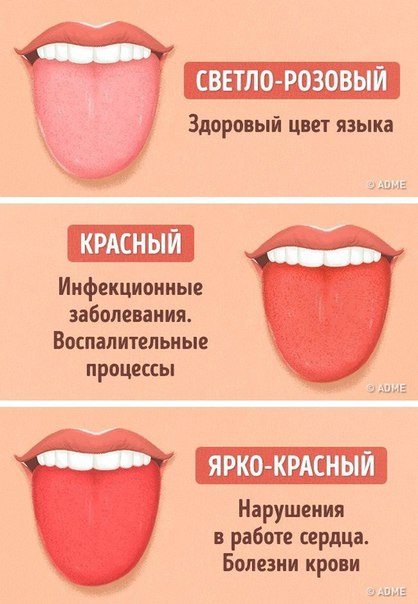 12 проблем, о которых может рассказать цвет языка.
